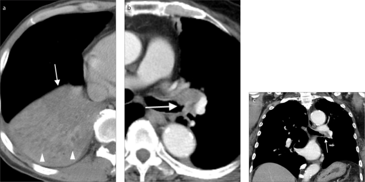 Figure 3. a–c