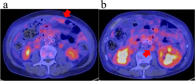 Fig. 3