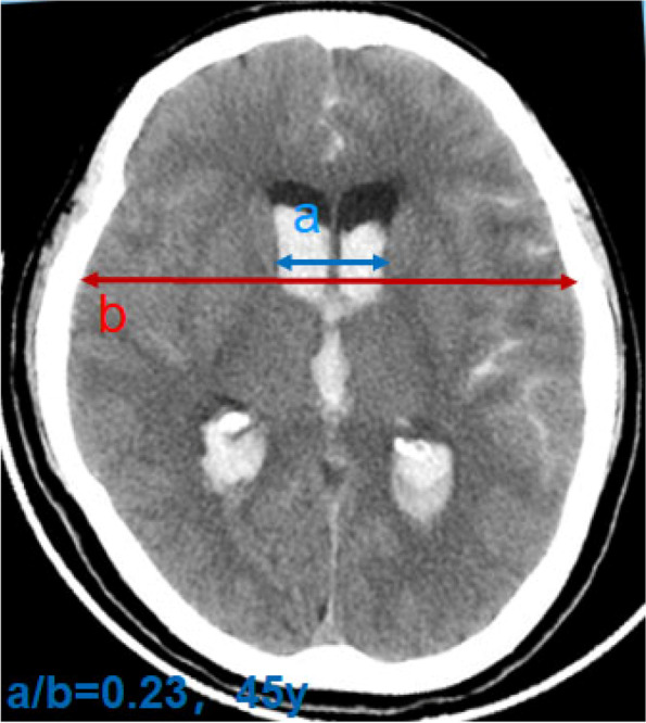 Fig. 1