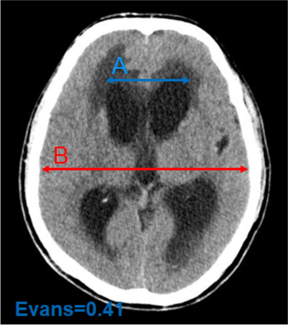 Fig. 2