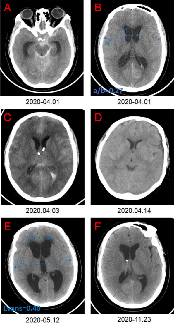 Fig. 3