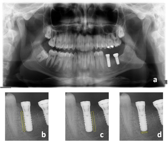 Fig. 2 