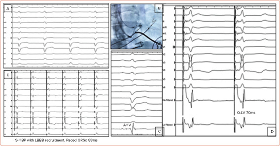 Figure 2: