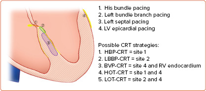 Figure 1: