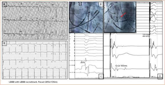 Figure 3: