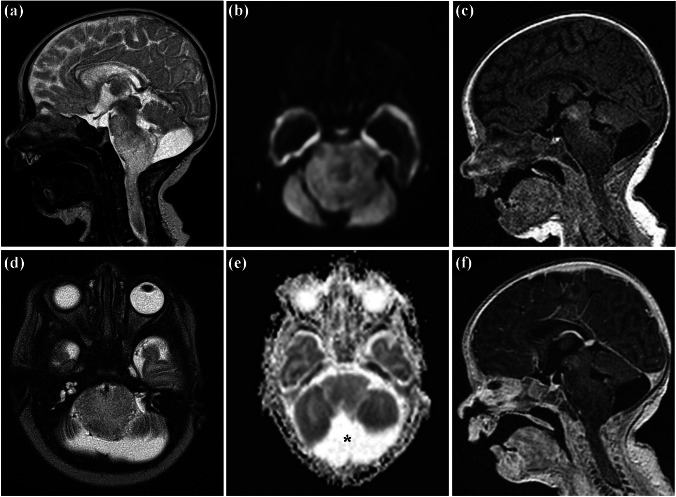 Fig. 4