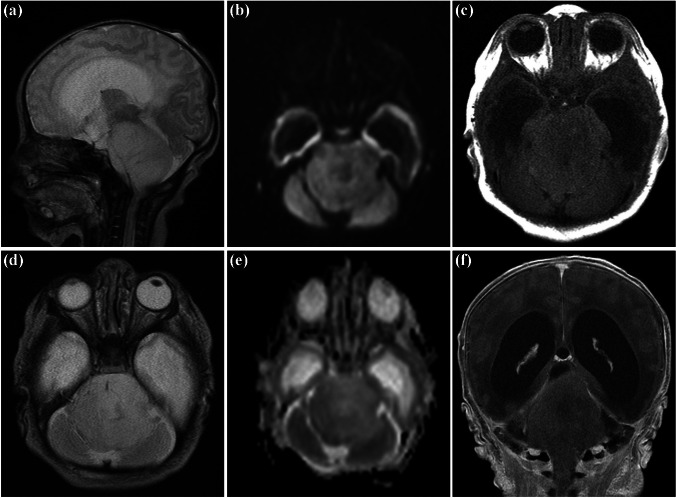 Fig. 1