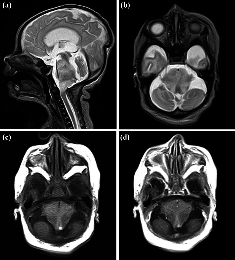 Fig. 2