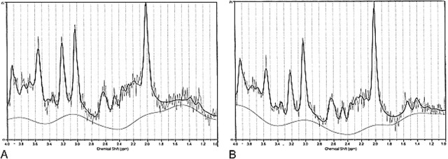 fig 2.