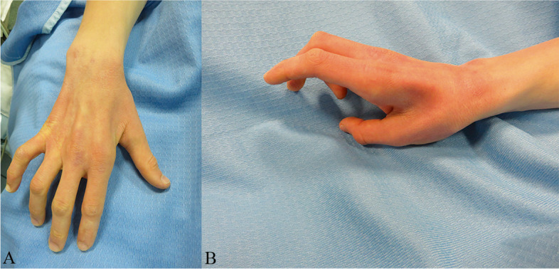 Fig. 1