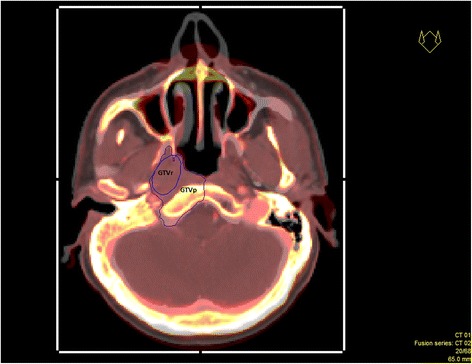 Fig. 2