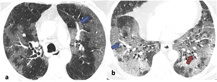 Fig. 5