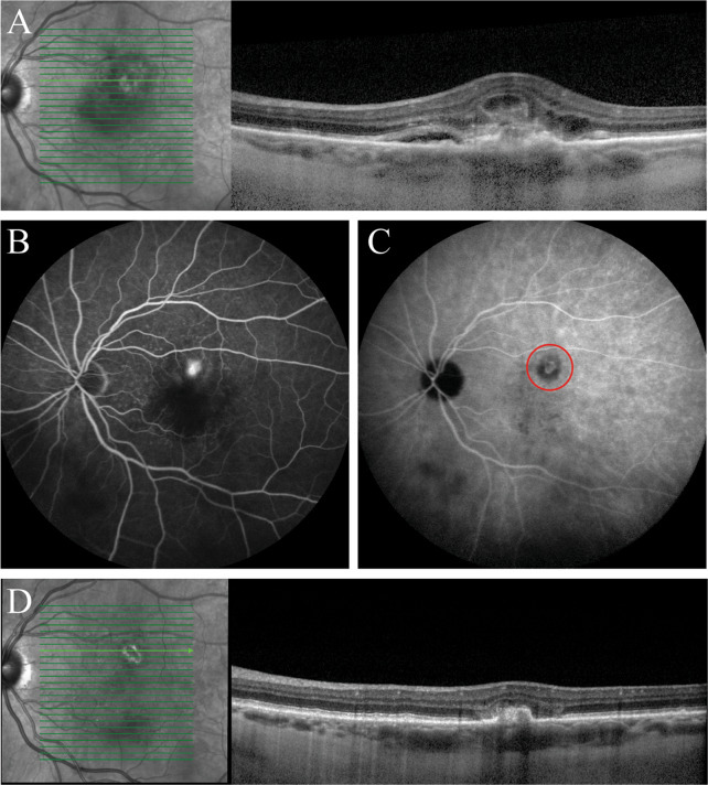 Fig. 2