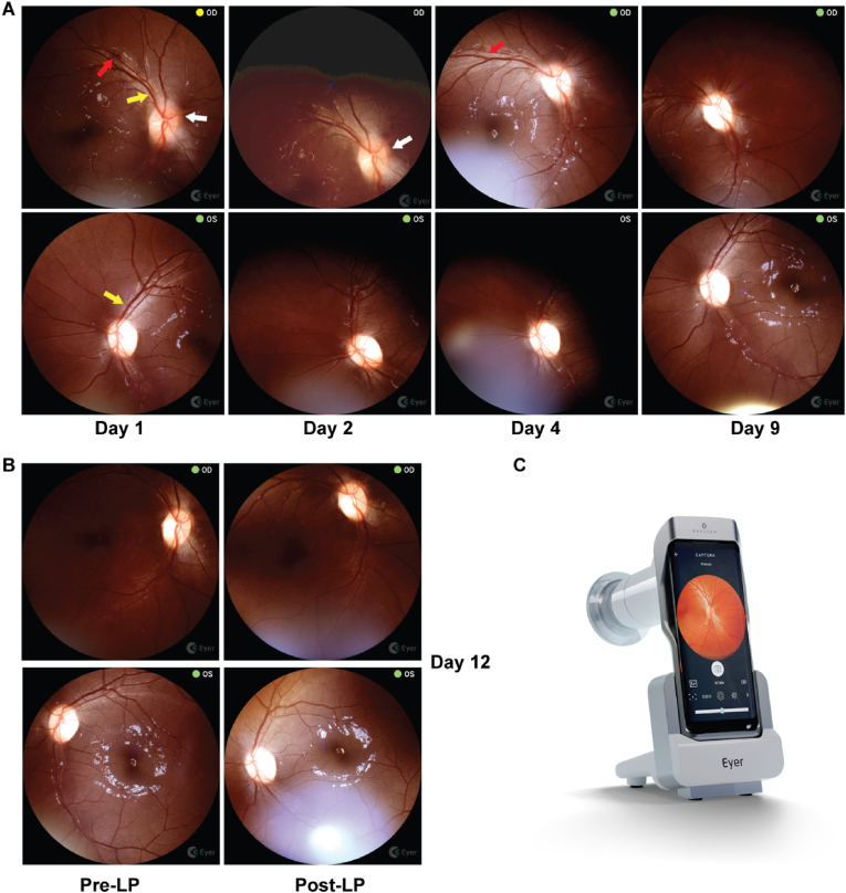 Fig. 2