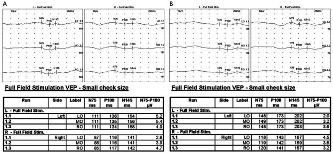 Fig. 4