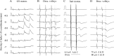 Fig. 9.