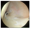 Fig. (3)