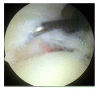 Fig. (2)