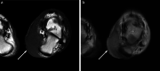 Fig. 13