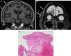 Fig. 11