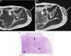 Fig. 12