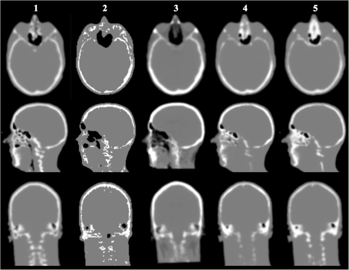 Fig. 4