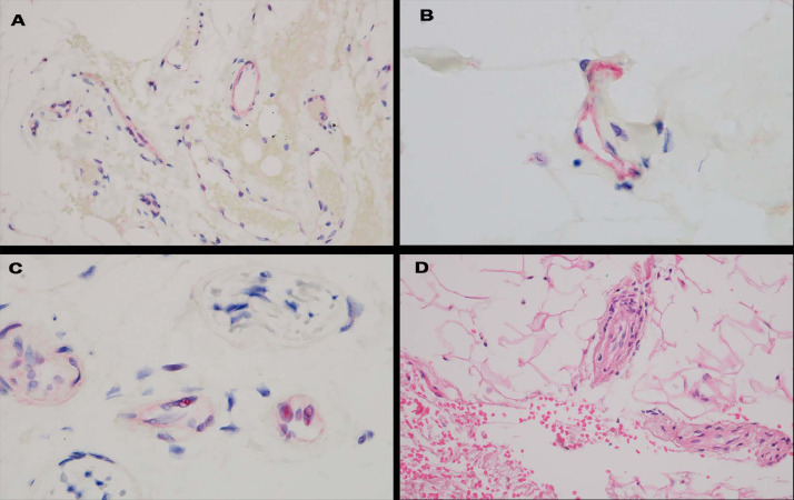 Fig 16