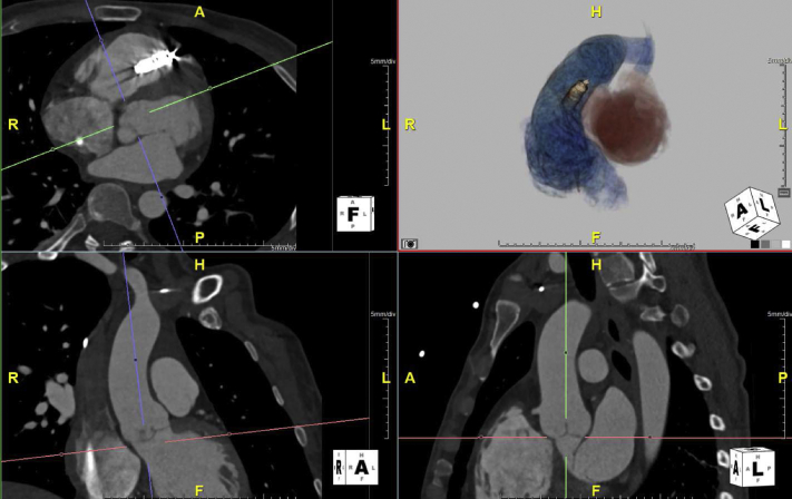 Figure 2