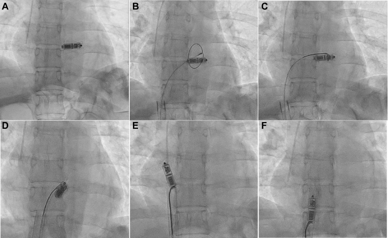 Figure 3