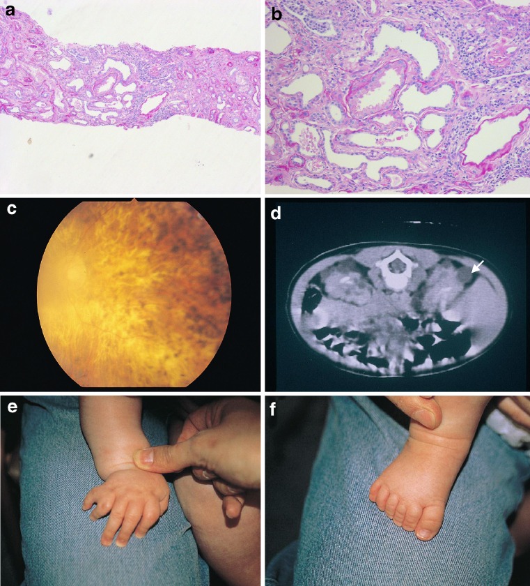 Fig. 3