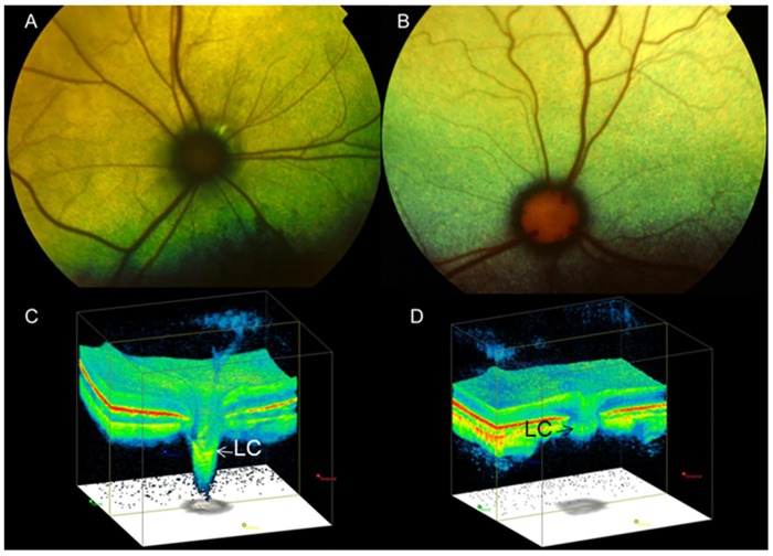 Fig 4