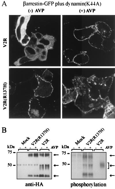 Constitutive arrestin-mediated desensitization of a human vasopressin ...