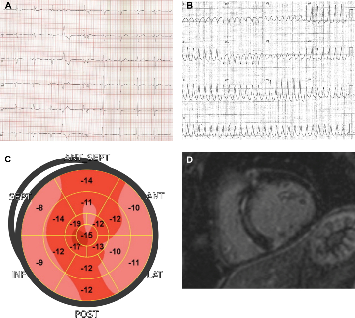 Figure 3