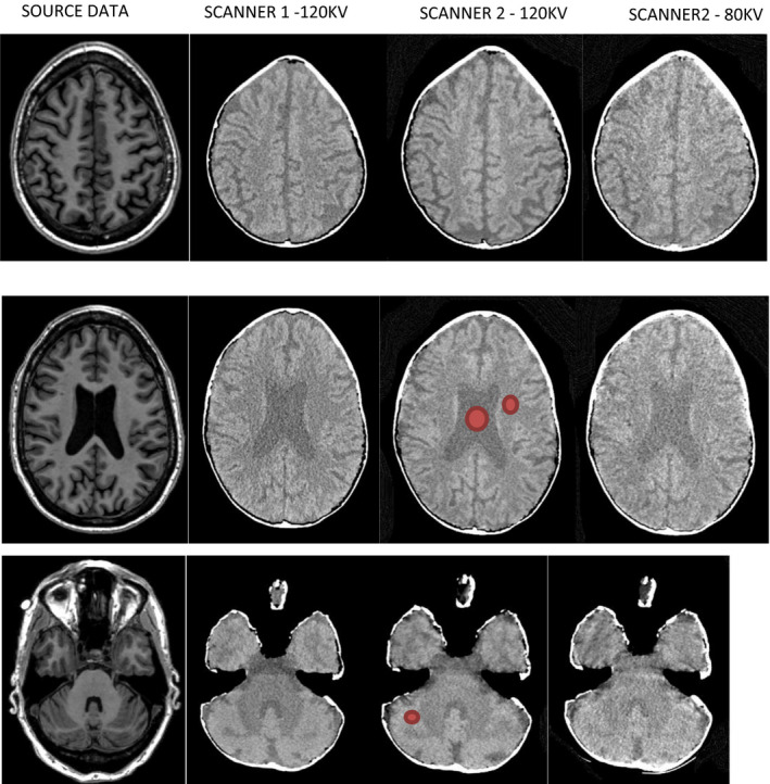 Fig. 2