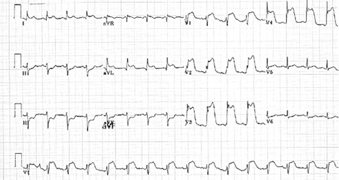 Fig. 1