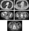 FIG. 2.
