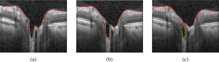 Fig. 10