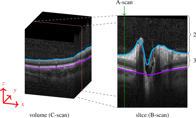 Fig. 1