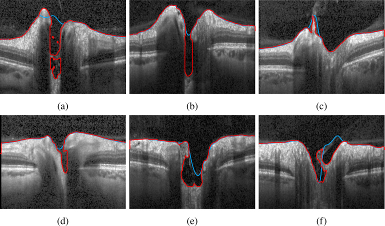 Fig. 11