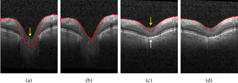 Fig. 3