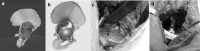 Fig. 10