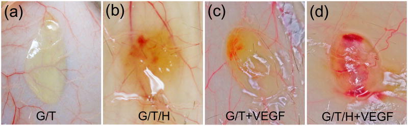 Fig 11