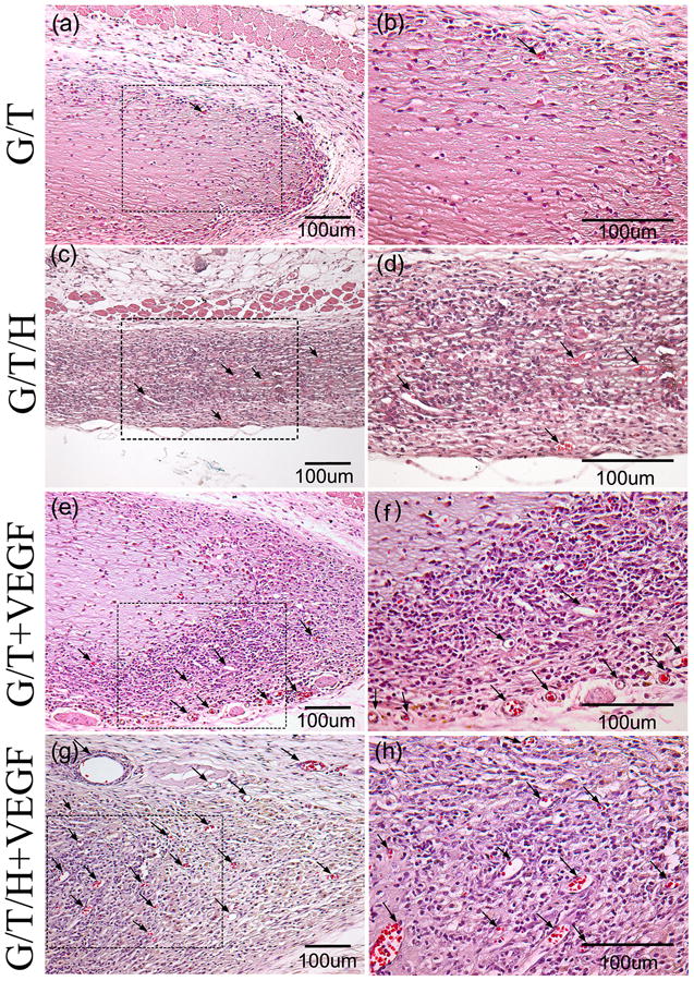 Fig 12