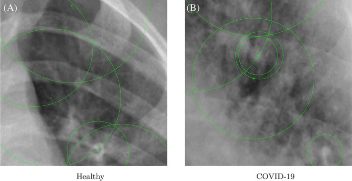 FIGURE 4