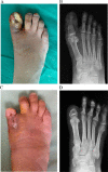 Fig. 4