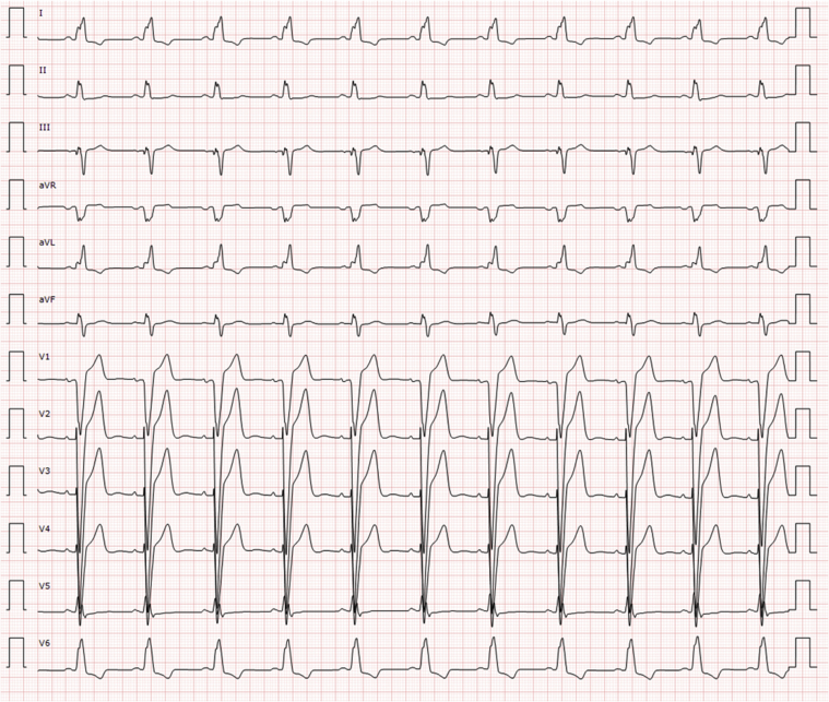 Figure 3