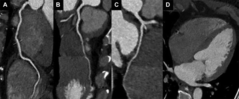 Figure 4