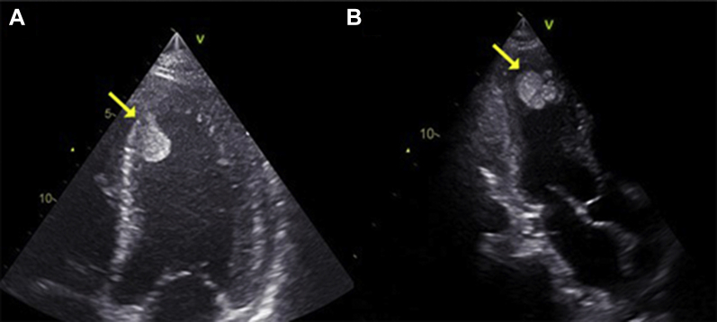 Figure 2