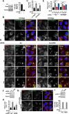 Figure 3—figure supplement 1.