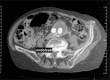 Fig 13